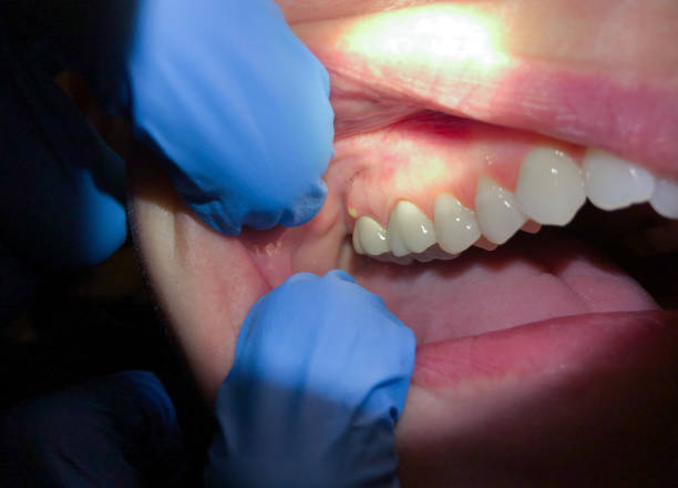 Best Pediatric Emergency Dentist in Boron, CA